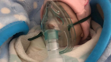 The 18-day old infant, Yaqeen al-Akeel, is hooked up to an oxygen tank. (Shared with permission of the parents).