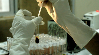 Blood samples - AFP