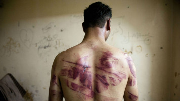 Syria torture AFP