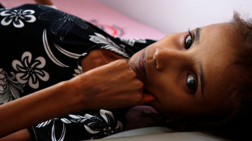 Yemen famine -- getty